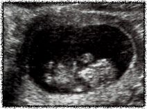 My first ultrasound Jan 28, 2004-10 weeks