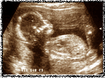 Second set ultrasounds-16 weeks-10 March 2004