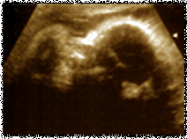 econd set ultrasounds-16 weeks-10 March 2004